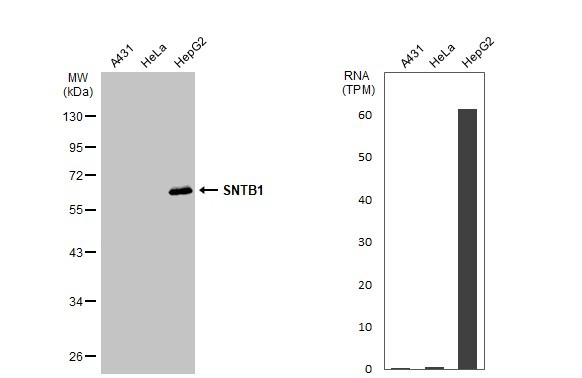 SNTB1 Antibody in Western Blot (WB)