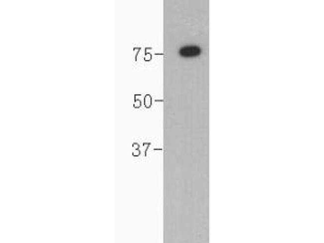 Complement C4b Antibody in Western Blot (WB)