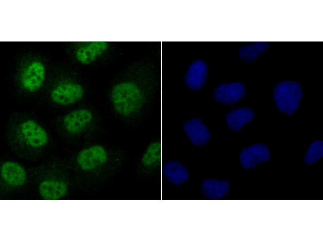 Cdc25C Antibody in Immunocytochemistry (ICC/IF)