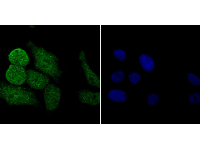 PKC beta Antibody in Immunocytochemistry (ICC/IF)