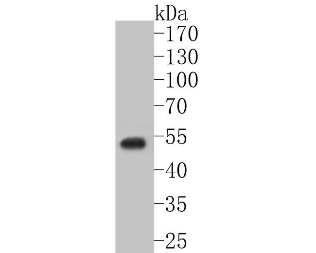 GABRD Antibody in Western Blot (WB)