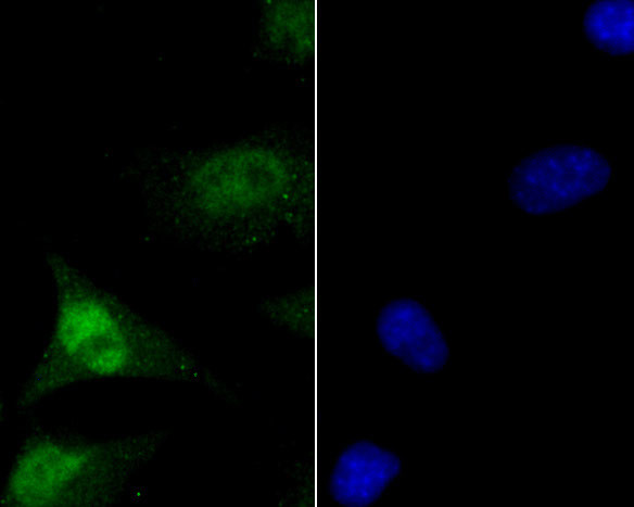 MCM7 Antibody in Immunocytochemistry (ICC/IF)