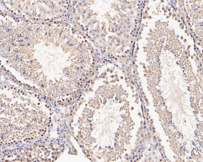 C2orf33 Antibody in Immunohistochemistry (Paraffin) (IHC (P))