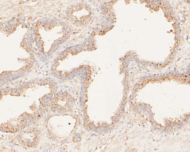 MAGT1 Antibody in Immunohistochemistry (Paraffin) (IHC (P))