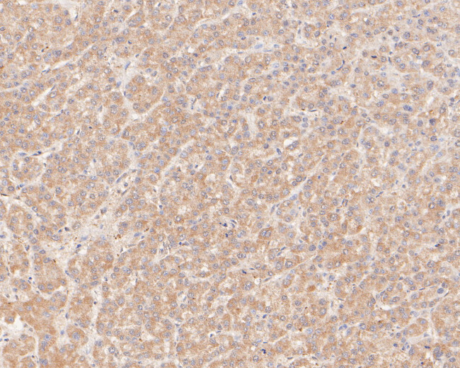 GBP2 Antibody in Immunohistochemistry (Paraffin) (IHC (P))