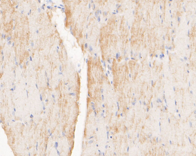 Myomegalin Antibody in Immunohistochemistry (Paraffin) (IHC (P))