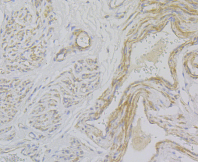 Smoothelin Antibody in Immunohistochemistry (Paraffin) (IHC (P))