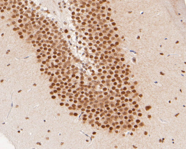 ILF1 Antibody in Immunohistochemistry (Paraffin) (IHC (P))