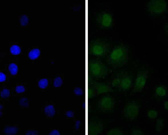 SSB Antibody in Immunocytochemistry (ICC/IF)