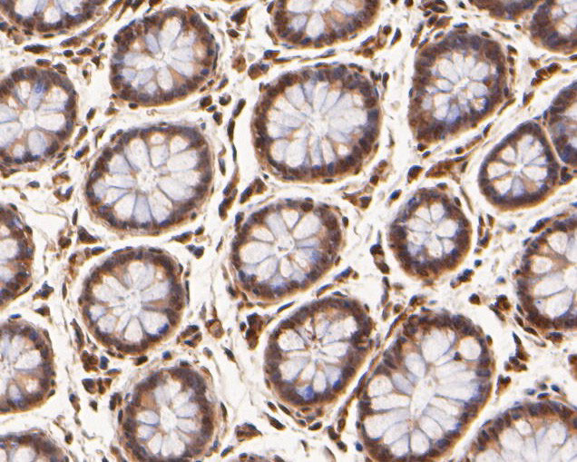 p21 ARC Antibody in Immunohistochemistry (Paraffin) (IHC (P))