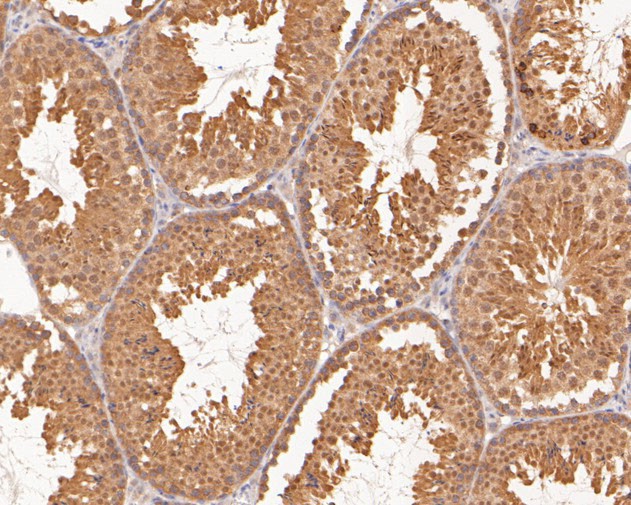 TMX4 Antibody in Immunohistochemistry (Paraffin) (IHC (P))