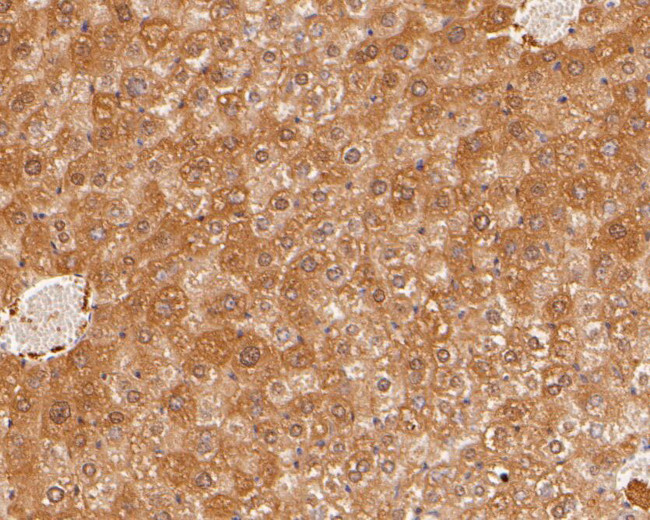 HPD Antibody in Immunohistochemistry (Paraffin) (IHC (P))
