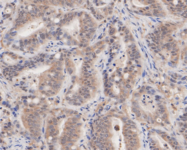 ASNA1 Antibody in Immunohistochemistry (Paraffin) (IHC (P))