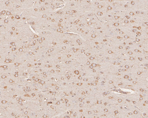 GDF1 Antibody in Immunohistochemistry (Paraffin) (IHC (P))