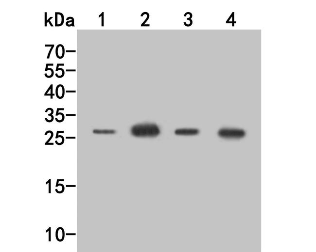 CD69 Antibody in Western Blot (WB)