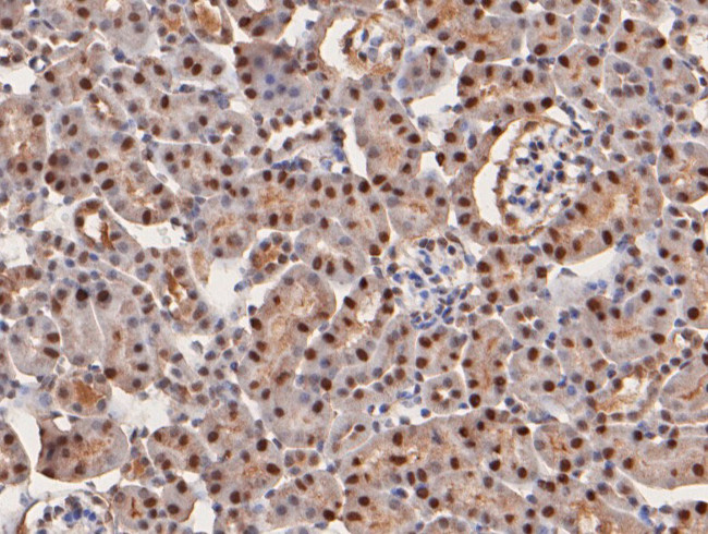 HOXA9 Antibody in Immunohistochemistry (Paraffin) (IHC (P))