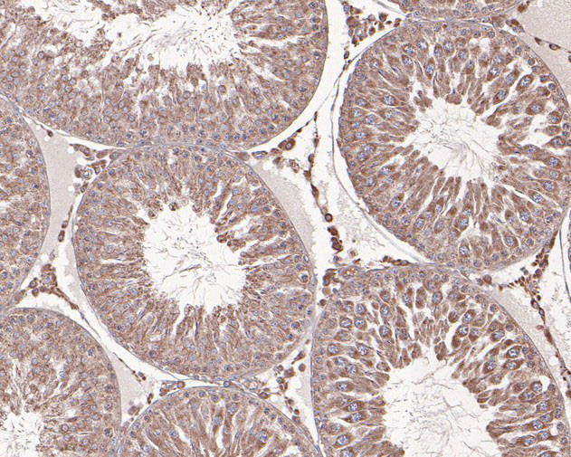 PPP3CC Antibody in Immunohistochemistry (Paraffin) (IHC (P))