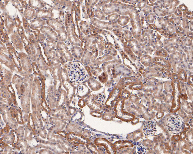 TRAP alpha Antibody in Immunohistochemistry (Paraffin) (IHC (P))