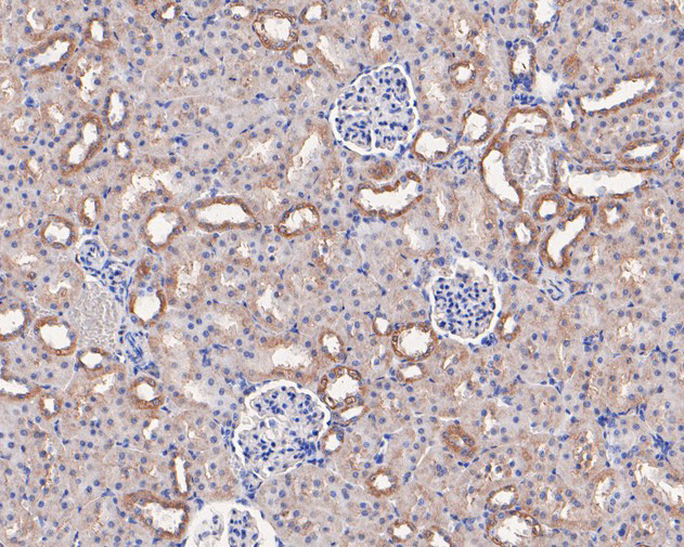 CD49c (Integrin alpha 3) Antibody in Immunohistochemistry (Paraffin) (IHC (P))