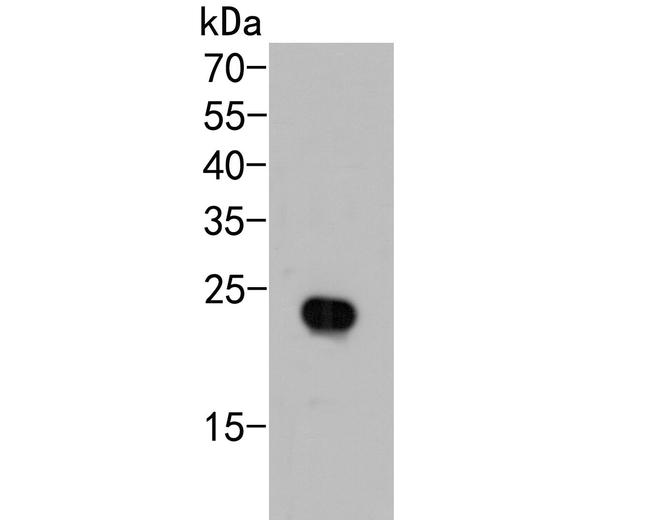 AP repeat Antibody in Western Blot (WB)
