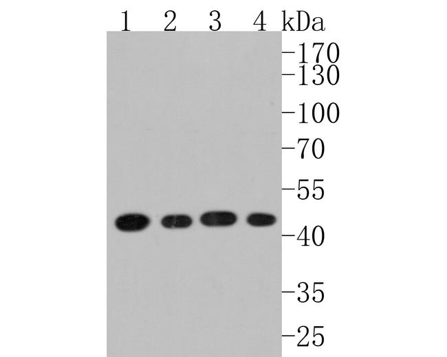 SCD Antibody in Western Blot (WB)