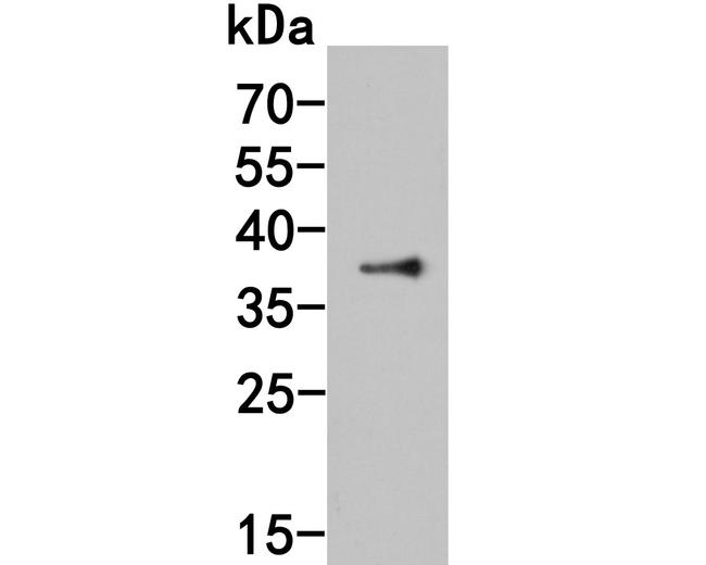 Histone Deacetylase Antibody in Western Blot (WB)