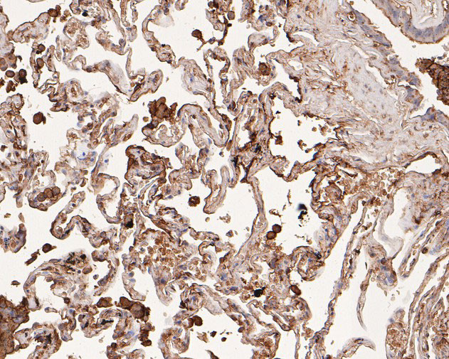 Aquaporin 4 Antibody in Immunohistochemistry (Paraffin) (IHC (P))