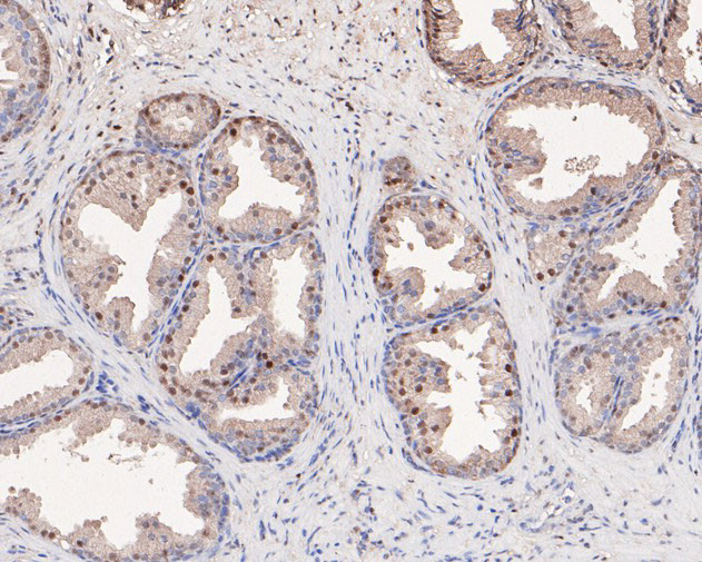 PP1 gamma Antibody in Immunohistochemistry (Paraffin) (IHC (P))