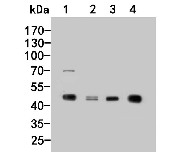 PIP4K2C Antibody in Western Blot (WB)