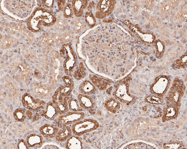 PRKCSH Antibody in Immunohistochemistry (Paraffin) (IHC (P))
