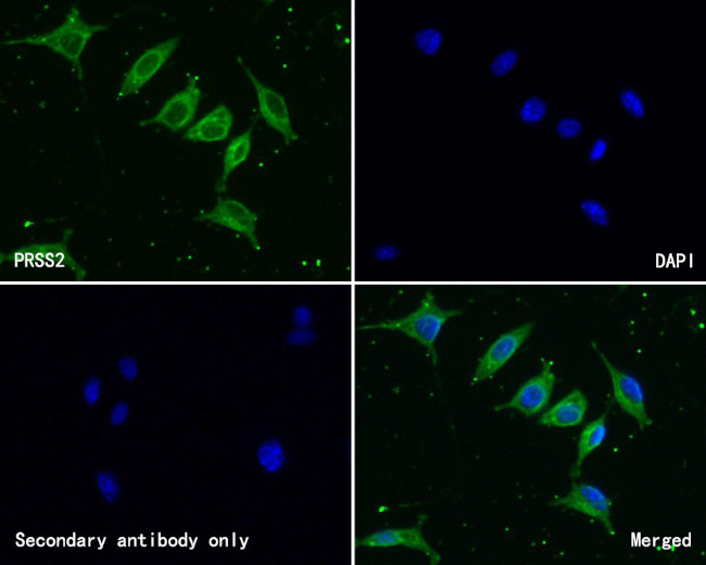 Trypsin 2 Antibody in Immunocytochemistry (ICC/IF)