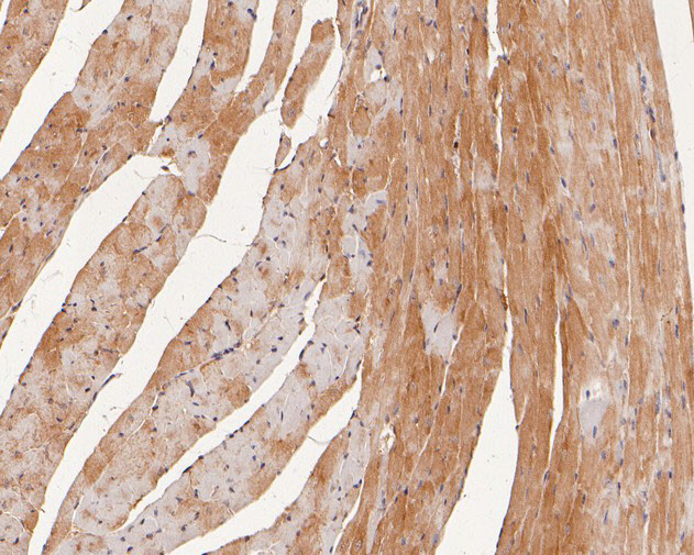 CTNNA3 Antibody in Immunohistochemistry (Paraffin) (IHC (P))