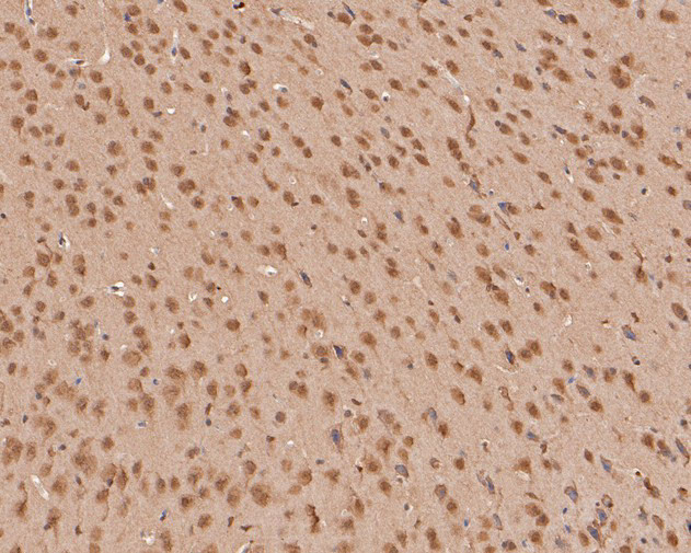ZIC2 Antibody in Immunohistochemistry (Paraffin) (IHC (P))