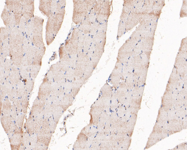 PIP5K1A Antibody in Immunohistochemistry (Paraffin) (IHC (P))