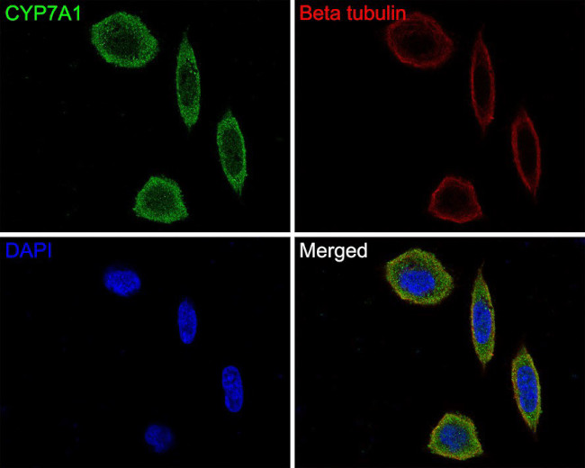 CYP7A1 Antibody in Immunocytochemistry (ICC/IF)