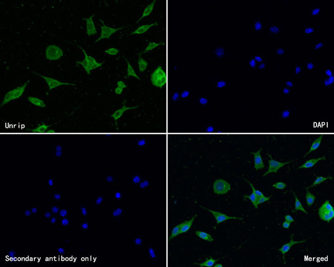 STRAP Antibody in Immunocytochemistry (ICC/IF)