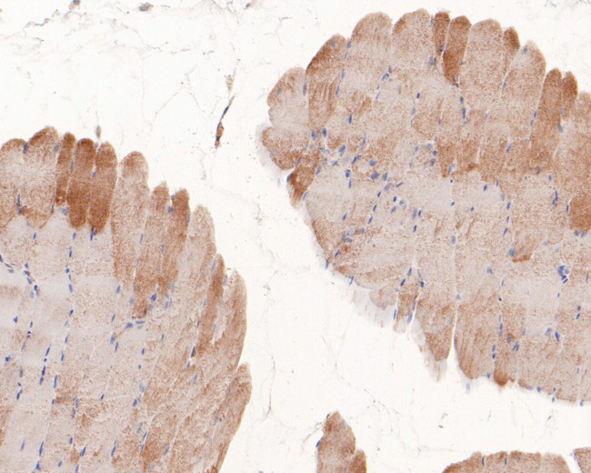 UBE2D1 Antibody in Immunohistochemistry (Paraffin) (IHC (P))