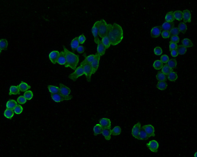 UBE2D3 Antibody in Immunocytochemistry (ICC/IF)