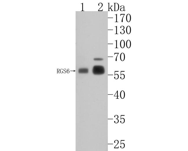 RGS6 Antibody in Western Blot (WB)