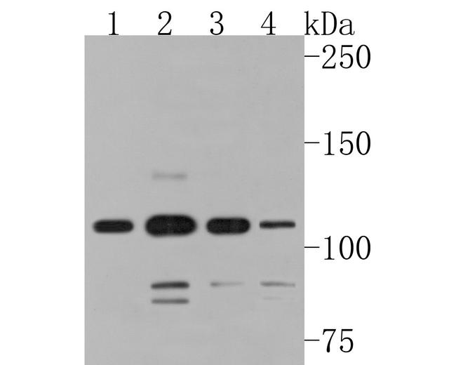 SMG5 Antibody in Western Blot (WB)