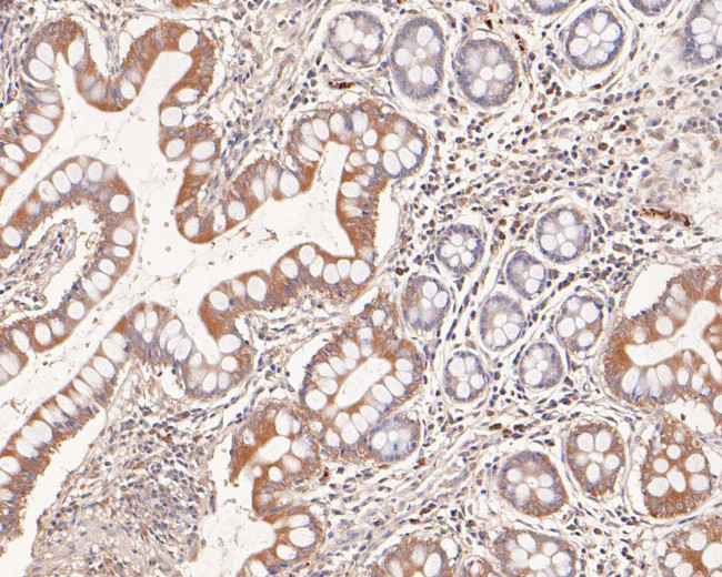 BTNL3 Antibody in Immunohistochemistry (Paraffin) (IHC (P))