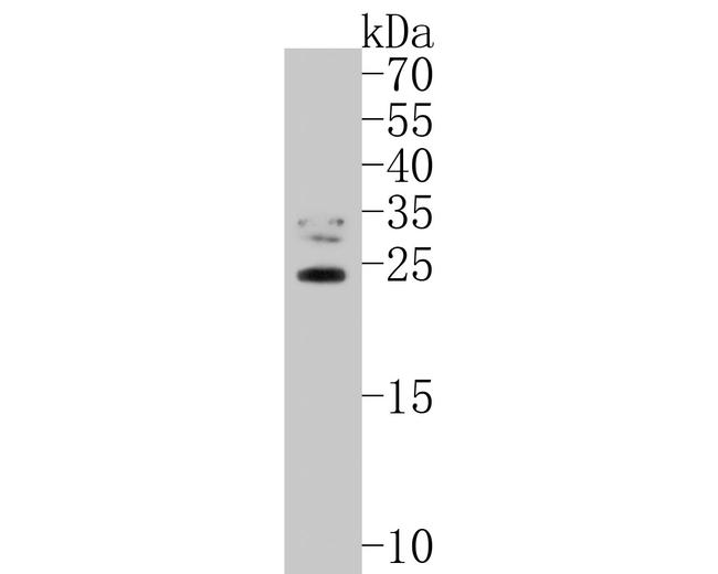 TIFY11A Antibody in Western Blot (WB)