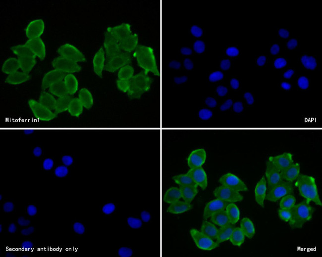 SLC25A37 Antibody in Immunocytochemistry (ICC/IF)