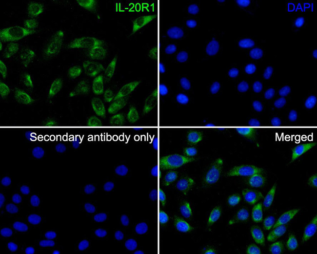 IL20RA Antibody in Immunocytochemistry (ICC/IF)