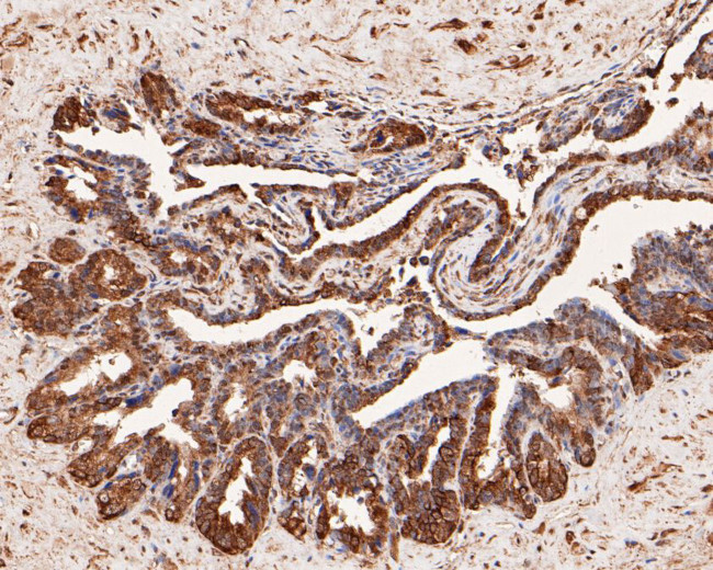 MYT1 Antibody in Immunohistochemistry (Paraffin) (IHC (P))
