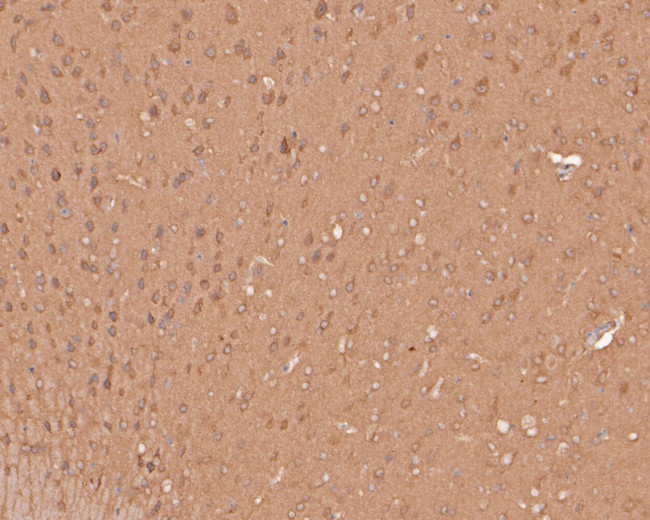 PLCB1 Antibody in Immunohistochemistry (Paraffin) (IHC (P))