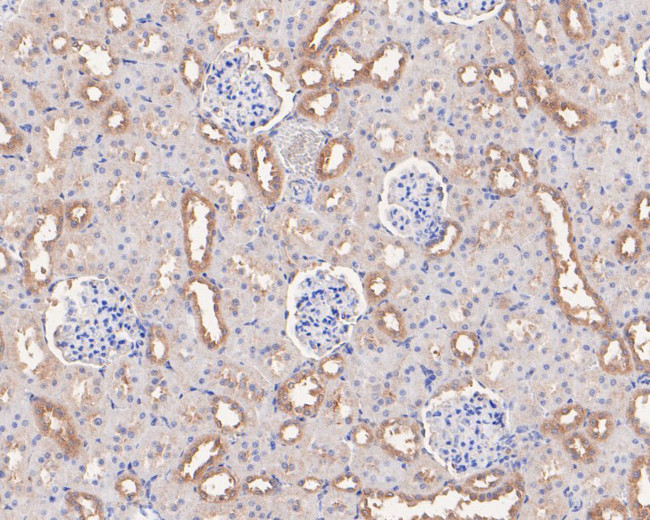 ARHGEF18 Antibody in Immunohistochemistry (Paraffin) (IHC (P))