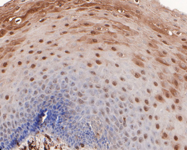 CLIC3 Antibody in Immunohistochemistry (Paraffin) (IHC (P))