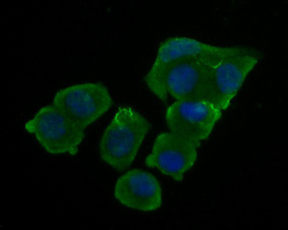 LRRTM1 Antibody in Immunocytochemistry (ICC/IF)