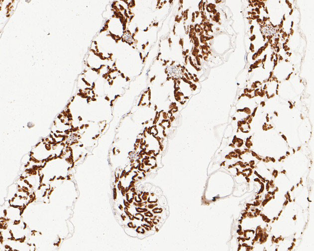 AP4E1 Antibody in Immunohistochemistry (Paraffin) (IHC (P))